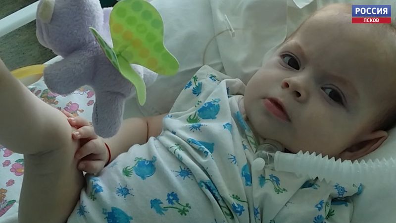 Псковичке Ане Струковой с синдромом Ундины необходима помощь